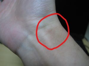 dorublog | ゴム手袋荒れの痒みに効く 液体ムヒ 新ウナコーワクール